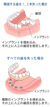 �C���v�����g���É摜